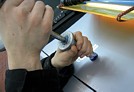 Dellen-Beseitigung: Klebe-Zieh-Technik